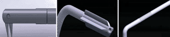 Image: The right angle laparoscopy scissors, petal-shape ureter dilator, and guide tube (Photo courtesy of Chinese Medical Journal).